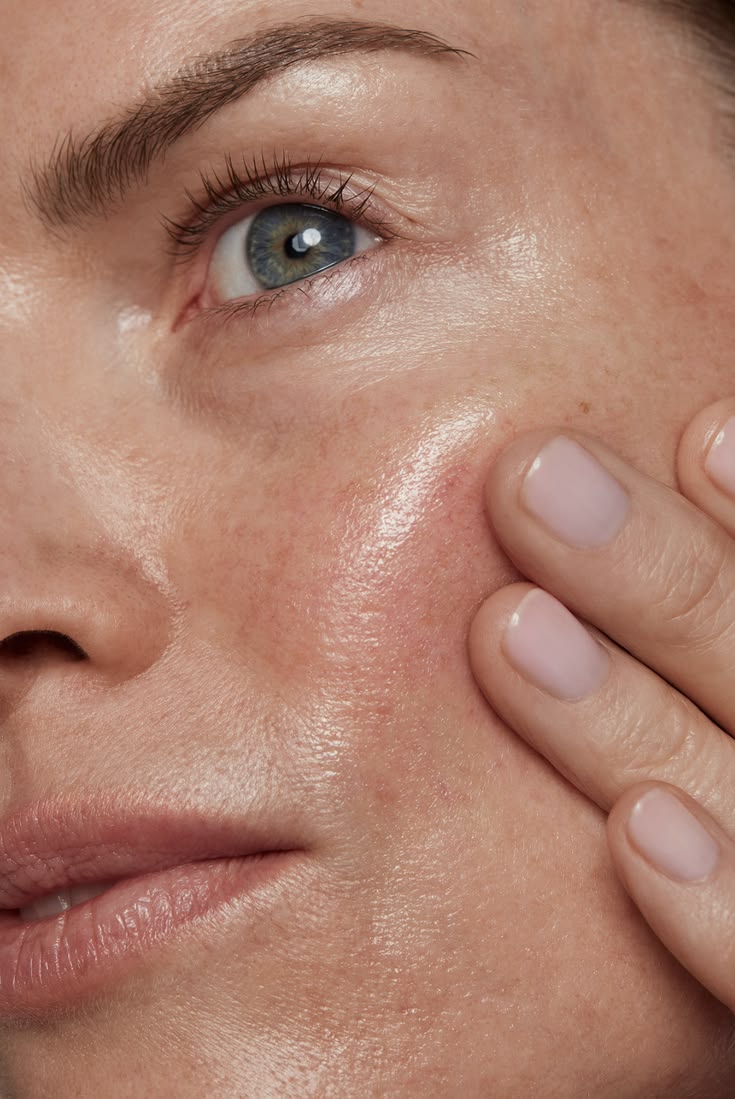 Managing Redness & Sensitivity During Colder Months