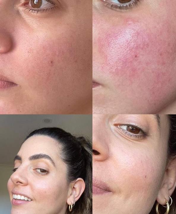 Dolce Vita Skin