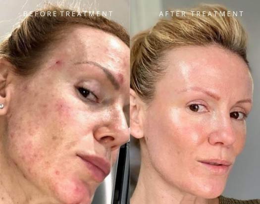 Dolce Vita Skin